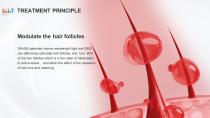 SH650-1 Laser hair growth machine-14