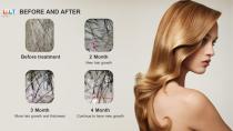 SH650-1 Laser hair growth machine-19