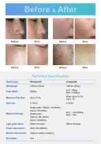  SP-7 Long Pulse Nd Yag Laser/ Pigmented lesion treatment laser-11
