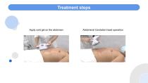 V-shaping-15