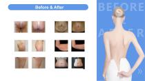 V-shaping-16