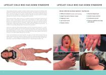 LIFECAST-5