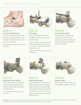 STEP IMPLANT SYSTEM-3
