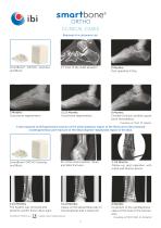 Brochure-SmartBone-Ortho.-6