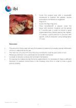 Surgical-procedures-SmartBone-4