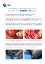 Surgical-procedures-SmartBone-5