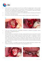 Surgical-procedures-SmartBone-6