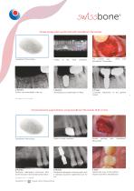swiss bone-7