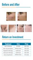 SHR IPL hair removal OPT-B - 7