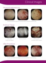 GynoVision Hysteroscopy Platform-7