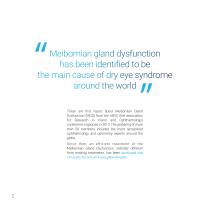 Dry-eye syndrome treatment using intense pulsed light technology-2