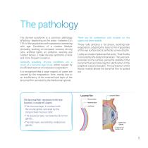 Dry-eye syndrome treatment using intense pulsed light technology-3