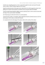 Volar -E Surgical Technique-15