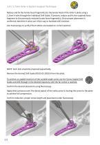 Volar -E Surgical Technique-16