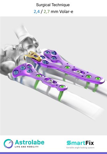Volar -E Surgical Technique