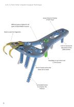 Volar -E Surgical Technique-8
