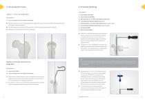 Navy A/R Femoral Nail Surgical Technique - 10