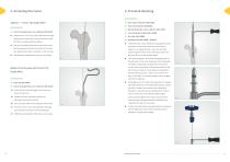 Neon Proximal Femoral Nail Surgical Technique-10