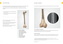 Neon Proximal Femoral Nail Surgical Technique-5
