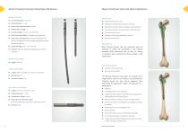 Neon Proximal Femoral Nail Surgical Technique-7