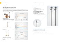 Nite Tibial Intramedullary Nail Surgical Technique-6