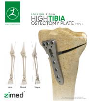 High Tibia Osteotomy Plate Type 2-1