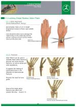 Lockng Hand-Wrist SURGICAL TECHNIQUE PLATE SYSTEM - Zimed Medical - PDF ...