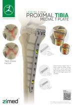 proximal-medial-tibial-Medial-T-plate-1