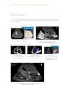 MedVision SonoVision brochure-6