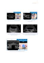 MedVision SonoVision brochure-7