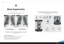 V-Suite Brochure-7