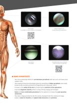 7StarScope Cannula Optic-5