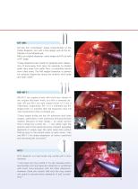 MIRANDA Dissector Set-5