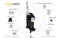 Dermatology laser CO2U700-8