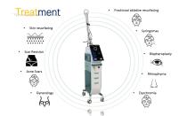 Fractional CO2 Laser Equipment for Acne Scar and Skin Renewal CO2U500-8