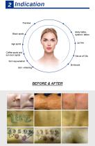 Picosecond Nd YAG Laser Tattoo Removal Skin Rejuvenation PICO VY12-4