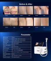 Portable 808nm Diode Laser Hair Removal (1200W) VNL-3-6