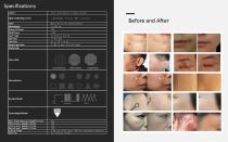 Scar removal laser CO2U500-9