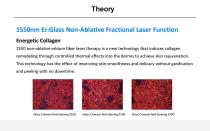 Skin rejuvenation laser VEL-004-4