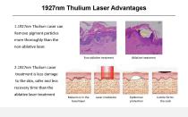 Thulium laser VTL-002 - 5