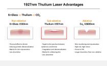 Thulium laser VTL-002 - 6