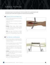 STRAIGHT COMPRESSION PLATING SYSTEM SURGICAL TECHNIQUE-6