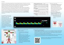 NewroSim™ - 2