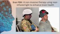 Science behind the WeberBrain®-3
