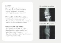 Bone Grafts – Portfolio-10