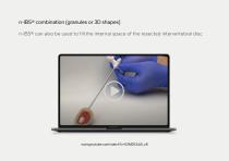 Bone Grafts – Portfolio-15