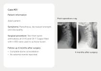 Bone Grafts – Portfolio-17