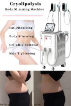 The best cryolipolysis machine manufacturer-BVLASER. Cryolipolysis fat freeze slimming machine. Cryolipolysis body contouring.-1