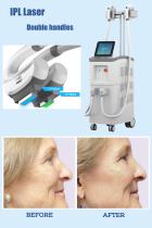 The best IPL laser machine professional. China OPT IPL SHR laser equipment-BVLASER.-1