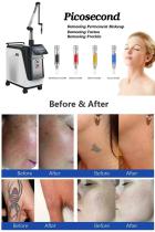 OEM picosecond laser machine-BVLASER. CE certification picosecond laser tattoo removal machine. High power picosecond laser.-1